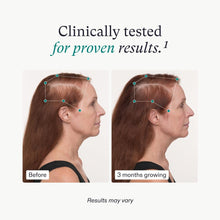 Load image into Gallery viewer, Nutrafol Women’s Balance 3 Month Supply