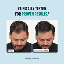 Load image into Gallery viewer, Nutrafol Men 3-Month Supply